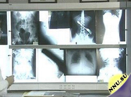 Удивительные рентгеновские снимки